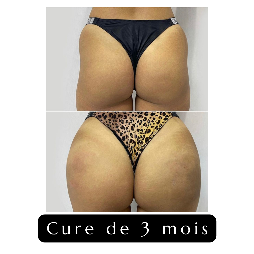 Gummies Volume Express Buttocks & Hips