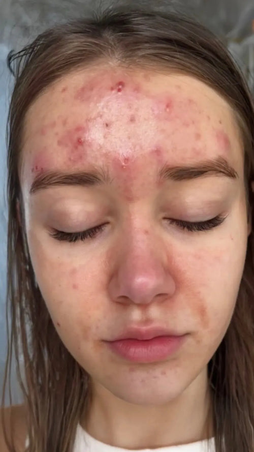 Jesssica R. before