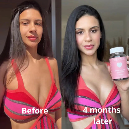 CURVANA - Breast Gummies