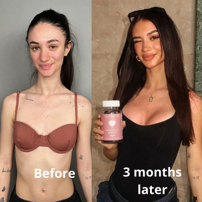 CURVANA - Breast Gummies