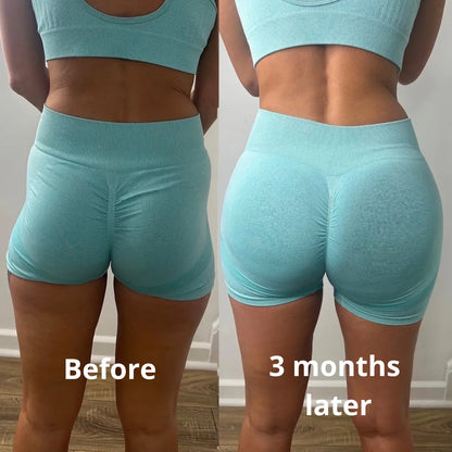 CURVANA - Booty & Hips Gummies